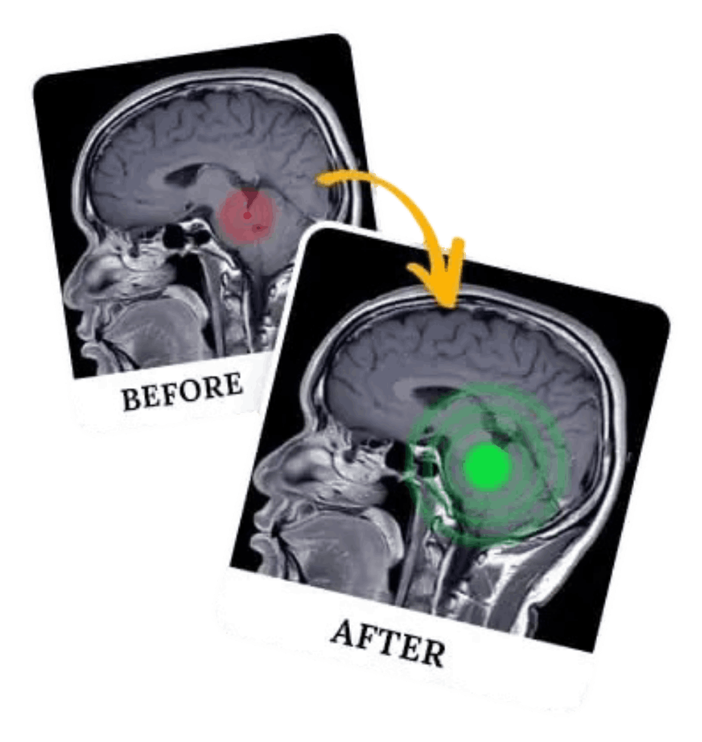 billionaire-brain-wave work